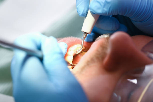 Best Tooth Infection Emergency Dentist  in Fulton, TX